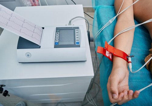 ECG Test